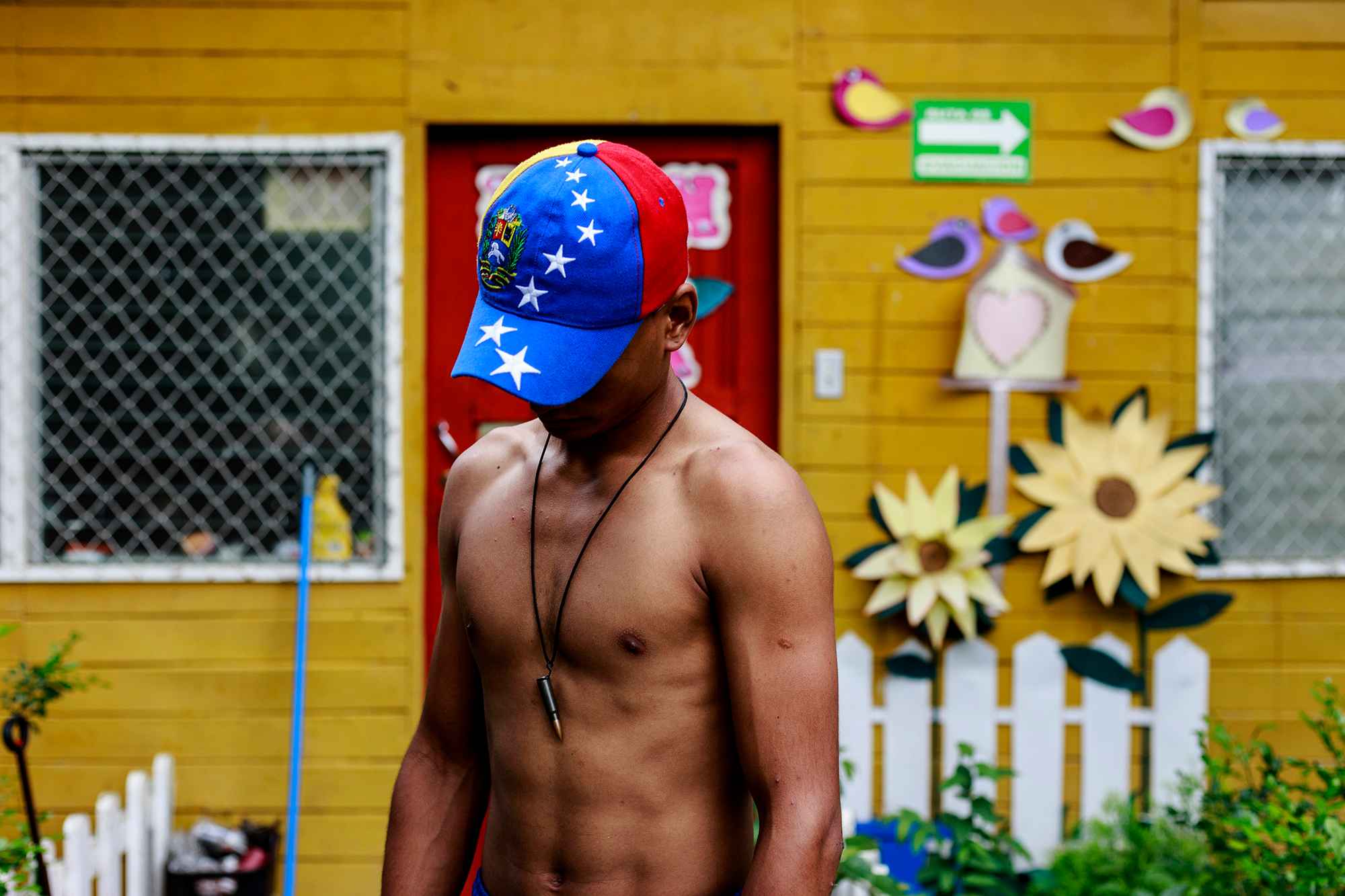 This young man, nicknamed "Venezuela," where he was born, carries a bullet from a Kalashnikov automatic rifle (AK-47) — the same weapon police forces used to attack the students. June 27, 2018.