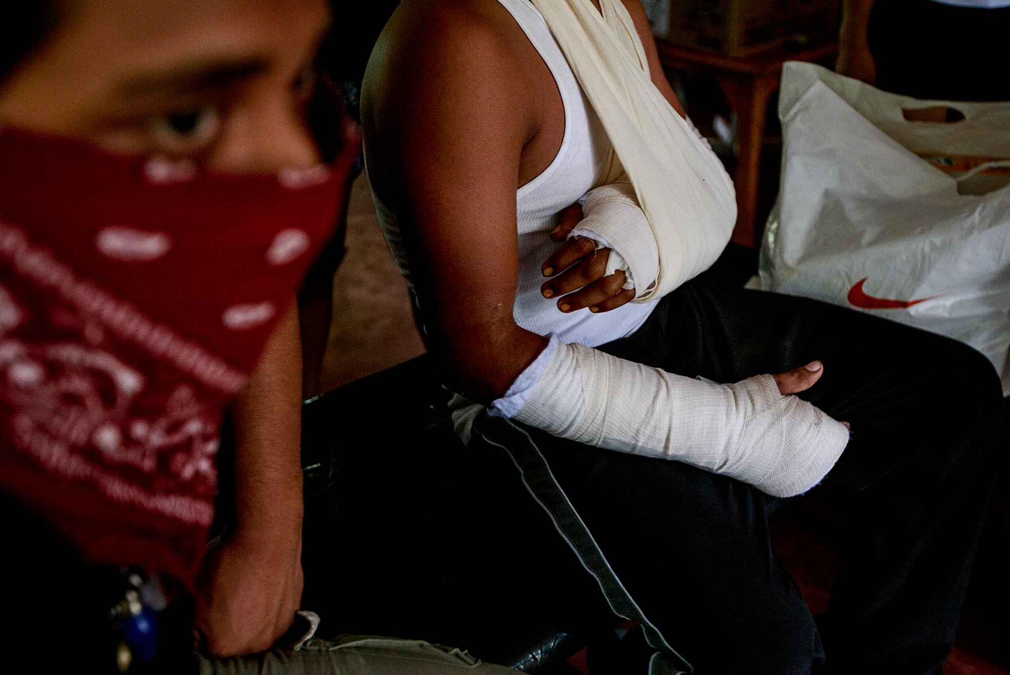 A student known as "Monimbó" sustained bullet wounds in both arms at the university during a police attack on Saturday, June 23, 2018.